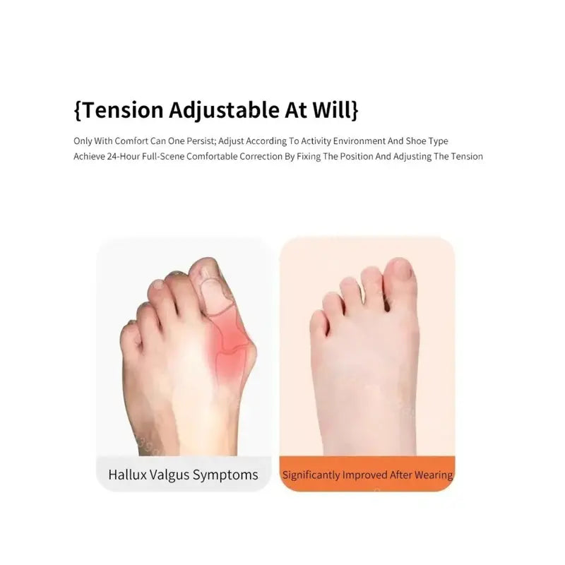 🦶 Orthopedic Bunion Corrector Strap—Foot pain shouldn't be a burden.
