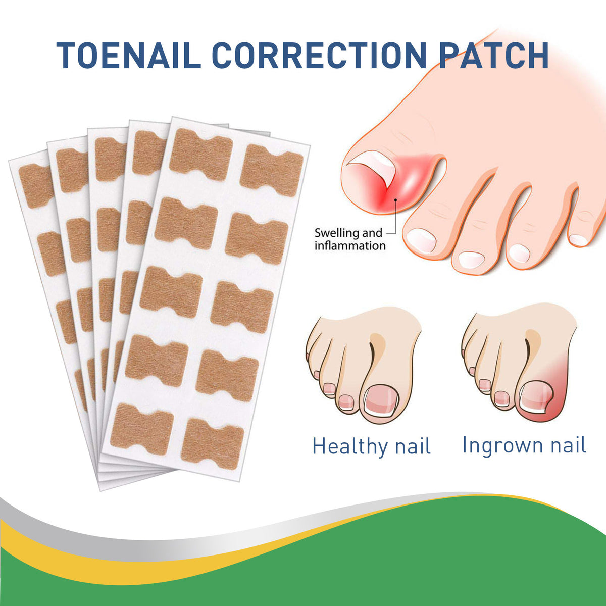👣Toenail Correction Strips – A Solution for Ingrown Toenails
